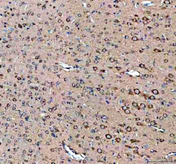 IHC staining of FFPE rat brain tissue with Sacsin antibody, HRP-labeled secondary and DAB substrate. HIER: boil tissue sections in pH8 EDTA for 20 min and allow to cool before testing.