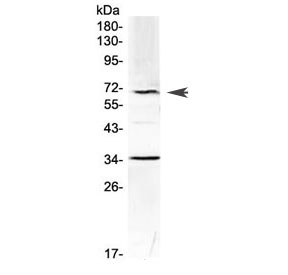 Alpha 1 Fetoprotein Antibody Mouse WB. Western blot testing of mouse HEPA1-6 cell lysate with Alpha 1 Fetoprotein antibody at 0.5ug/ml. Predicted molecular weight ~67 kDa.