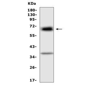 Alpha 1 Fetoprotein Antibody Rat WB. Western blot testing of rat RH35 cell lysate with Alpha 1 Fetoprotein antibody at 0.5ug/ml. Predicted molecular weight ~67 kDa.