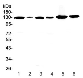 Western blot testing of human 1) HeLa, 2) placenta, 3) A549, 4) COLO320, 5) A431 and 6) SKOV3 cell lysate with VEGFR1 antibody at 0.5ug/ml. Predicted molecular weight ~150 kDa but may be observed at higher molecular weights due to glycosylation.