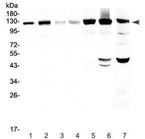 EPHA2 Antibody Multi-Cell Line WB. Western blot analysis of EPHA2 expression was performed using an Eph Receptor A2 antibody. Lane 1: human HeLa cell lysate. Lane 2: human U-87 MG cell lysate. Lane 3: human SHG-44 cell lysate. Lane 4: human COLO320 cell lysate. Lane 5: human SKOV3 cell lysate. Lane 6: human A549 cell lysate. Lane 7: mouse HEPA1-6 cell lysate. EPHA2, also known as Epithelial Cell Kinase and a Receptor Tyrosine Kinase, regulates cell adhesion, migration, and signal transduction through interactions with ephrin ligands. A prominent band is detected between approximately 108 and 130 kDa, consistent with the expected molecular weight of mature glycosylated EPHA2. Additional lower molecular weight species observed in A549 and HEPA1-6 cells may represent proteolytic fragments or differentially processed receptor forms. These results demonstrate broad EPHA2 expression across epithelial, neural, ovarian, pulmonary, and hepatic cell types and support the utility of Eph Receptor A2 Antibody for studies of cancer biology and receptor signaling.