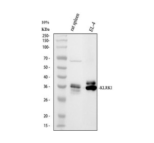 NKG2D Antibody Mouse EL-4 Cell and Rat Spleen WB. Western blot analysis of NKG2D Antibody / KLRK1 Antibody detected immunoreactive bands in rat spleen and mouse EL-4 cell lysates. Lanes: (1) rat spleen tissue and (2) mouse EL-4 whole cell lysates. The predominant band is observed at approximately 35 kDa, somewhat higher than the predicted molecular weight of 25 kDa, which is consistent with the extensive N-linked glycosylation known to occur on the extracellular domain of NKG2D. This post-translational modification commonly increases the apparent molecular weight observed by western blot. This NKG2D Antibody supports western blot studies of KLRK1, natural killer cell activation, cytotoxic lymphocyte biology, and immune surveillance.