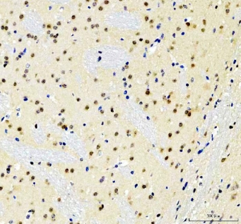 IHC staining of FFPE mouse brain tissue with SOX10 antibody. HIER: boil tissue sections in pH8 EDTA for 20 min and allow to cool before testing.