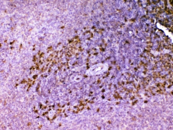 IHC testing of FFPE rat spleen tissue with Ada antibody at 1ug/ml. Required HIER: steam section in pH6 citrate buffer for 20 min and allow to cool prior to testing.