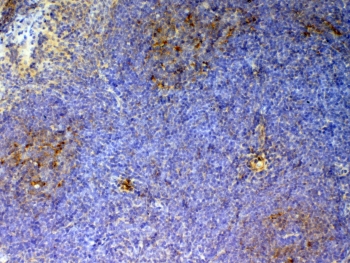 IHC testing of FFPE mouse spleen tissue with Cd59 antibody at 1ug/ml. Required HIER: steam section in pH6 citrate buffer for 20 min and allow to cool prior to testing.