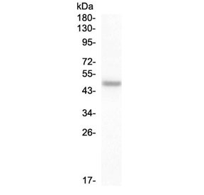 PAX8 Antibody / Epithelial Lineage Stability Marker Antibody western blot analysis in human SW579 cell lysate. A band is detected at approximately 55-60 kDa, above the predicted molecular weight of Paired box protein Pax-8 (PAX8) at ~48 kDa. The observed upward shift in apparent molecular weight is consistent with post-translational modification or altered electrophoretic mobility commonly seen in nuclear transcription factors. This banding pattern supports detection of PAX8 and reflects its stable expression in epithelial lineage cells maintaining transcriptional identity.