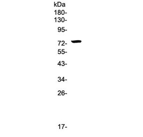 Western blot testing of human HepG2 cell lysate with IRAK1 antibody at 0.5ug/ml. Predicted molecular weight ~76 kDa.