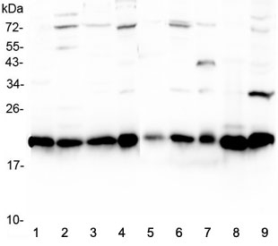 Western blot testing of rat 1) brain, 2) spleen, 3) testis, 4) PC-12 and mouse 5) brain, 6) spleen, 7) testis, 8) HEPA1-6 and 9) NIH3T3 lysate with CBX3 antibody at 0.5ug/ml. Predicted molecular weight ~21 kDa. 