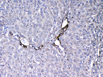 IHC testing of FFPE rat liver tissue with VEGF Receptor 3 antibody at 1ug/ml. Required HIER: steam section in pH6 citrate buffer for 20 min and allow to cool prior to testing.