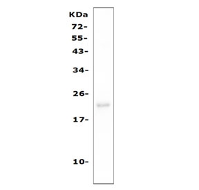 Western blot testing of mouse RAW264.7 cell lysate with CD81 antibody. Expected molecular weight: 22-26 kDa.