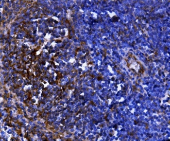 IHC staining of FFPE mouse liver with Cd81 antibody. HIER: boil tissue sections in pH8 EDTA buffer for 20 min and allow to cool before testing. Green=isotype control, Blue= Cd81 antibody.