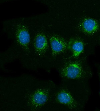 Immunofluorescent staining of FFPE mouse RM-1 cells with Cd81 antibody (green) and DAPI nuclear stain (blue). HIER: steam section in pH6 citrate buffer for 20 min.