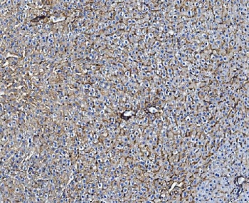 IHC staining of FFPE rat liver with Cd81 antibody. HIER: boil tissue sections in pH8 EDTA buffer for 20 min and allow to cool before testing. Green=isotype control, Blue= Cd81 antibody.