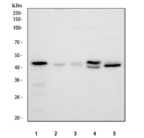 Western blot testing of 1) human ThP-1, 2) human HepG2, 3) human HeLa, 4) rat lung abd 5) rat kidney tissue lysate with GALT antibody. Predicted molecular weight ~43 kDa.