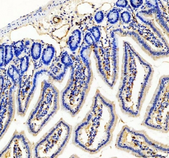 IHC staining of FFPE mouse colon tissue with CD31 antibody. HIER: boil tissue sections in pH8 EDTA for 20 min and allow to cool before testing.