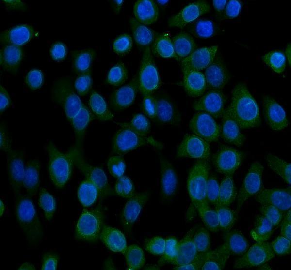 UGT1A1 Antibody / Drug Metabolism Enzyme Antibody CACO-2 Immunofluorescence. Immunofluorescent staining of CACO-2 cells using UGT1A1 Antibody / Drug Metabolism Enzyme Antibody (green) with DAPI nuclear counterstain (blue). Enzymatic antigen retrieval was performed for 15 minutes prior to staining. Cells were blocked with 10% goat serum and incubated with the primary antibody (5 ug/ml) overnight at 4Â°C, followed by a Fluoro488-conjugated goat anti-rabbit IgG secondary antibody. UGT1A1 displays predominantly cytoplasmic staining, consistent with its localization as a Phase II metabolic enzyme involved in bilirubin conjugation, glucuronidation, and the detoxification of endogenous compounds and therapeutic drugs.