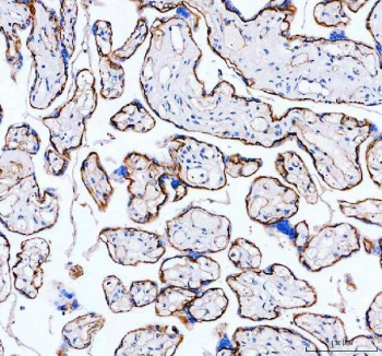 IHC testing of FFPE human placental tissue with ITGA5 antibody. Required HIER: steam section in pH8 EDTA buffer for 20 min and allow to cool prior to testing.