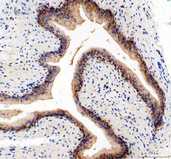 IHC testing of FFPE rat bladder tissue with ITGA5 antibody. Required HIER: steam section in pH8 EDTA buffer for 20 min and allow to cool prior to testing.