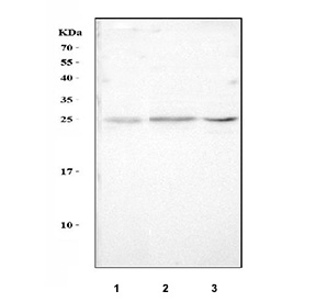 Western blot testing of 1) rat PC-12, 2) mouse kidney and 3) mouse Neuro-2a cell lysate with NMU antibody at 0.5ug/ml. Expected molecular weight: 20-25 kDa.