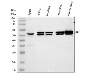 Glycerol Kinase Antibody Human, Mouse and Rat WB. Western blot analysis of Glycerol Kinase Antibody using lysates from lane 1: human HepG2 cells, lane 2: rat liver, lane 3: rat kidney, lane 4: mouse liver and lane 5: mouse kidney. Specific bands are detected at approximately 57-61 kDa, consistent with the expected molecular weight of endogenous glycerol kinase. The closely spaced doublet likely reflects alternative isoforms and/or post-translationally modified forms of the protein. These results demonstrate cross-species detection of glycerol kinase in metabolically active tissues and support the use of Glycerol Kinase Antibody, a Lipid Metabolism Enzyme Antibody, for studies of glycerol metabolism, hepatic function and energy homeostasis.