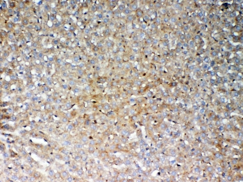 IHC testing of FFPE rat liver tissue with GALNS antibody at 1ug/ml. Required HIER: steam section in pH6 citrate buffer for 20 min and allow to cool prior to testing.