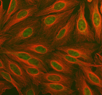 Immunofluorescent staining of FFPE human U-2 OS cells with PDK2 antibody (green) and Alpha Tubulin mAb (red). HIER: steam section in pH6 citrate buffer for 20 min.