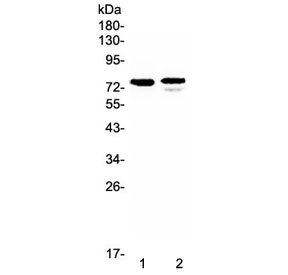 FZD3 Antibody SK-OV-3 / Jurkat WB. Western blot analysis of SK-OV-3 and Jurkat cell lysates using FZD3 Antibody demonstrates a prominent immunoreactive band at approximately 76 kDa, consistent with the expected molecular weight of FZD3 (Frizzled 3). FZD3 is a seven-transmembrane Wnt signaling receptor that regulates planar cell polarity, neural development, axon guidance, and tissue morphogenesis. The observed band is consistent with endogenous FZD3 expression and supports the utility of this antibody for western blot detection of Frizzled 3 in human cell lysates.