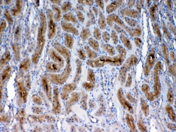 FZD3 Antibody Rat Kidney IHC. Immunohistochemical staining of FFPE rat kidney tissue using FZD3 Antibody demonstrates moderate to strong membranous and cytoplasmic staining within renal tubular epithelial cells. FZD3 is a Frizzled family Wnt signaling receptor that regulates cell polarity, tissue morphogenesis, and epithelial organization through Wnt-mediated signaling pathways. The observed staining pattern is consistent with FZD3 expression in renal tubular structures and supports the utility of this antibody for immunohistochemical detection of Frizzled 3 in FFPE rat tissues. HIER: steam section in pH6 citrate buffer for 20 minutes and allow to cool prior to testing.