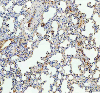 IHC staining of FFPE rat lung tissue with TSPAN12 antibody, HRP-labeled secondary and DAB substrate. HIER: boil tissue sections in pH8 EDTA for 20 min and allow to cool before testing.