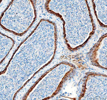 Immunohistochemical staining of FFPE mouse epididymis tissue with DYNLT1 antibody, HRP-secondary and DAB substrate. HIER: boil tissue sections in pH8 EDTA for 20 min and allow to cool before testing.