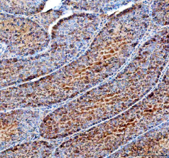 Immunohistochemical staining of FFPE mouse testis tissue with DYNLT1 antibody, HRP-secondary and DAB substrate. HIER: boil tissue sections in pH8 EDTA for 20 min and allow to cool before testing.