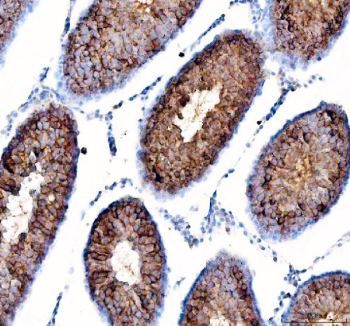 Immunohistochemical staining of FFPE rat testis tissue with DYNLT1 antibody, HRP-secondary and DAB substrate. HIER: boil tissue sections in pH8 EDTA for 20 min and allow to cool before testing.