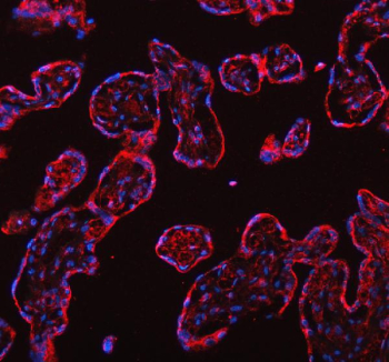 Immunofluorescent staining of FFPE human placental tissue with DYNLT1 antibody (red) and DAPI nuclear stain (blue). HIER: steam section in pH8 EDTA buffer for 20 min.