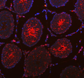 Immunofluorescent staining of FFPE rat testis tissue with DYNLT1 antibody (red) and DAPI nuclear stain (blue). HIER: steam section in pH8 EDTA buffer for 20 min.