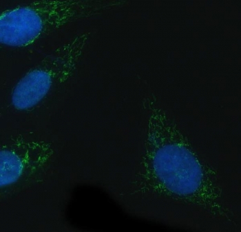 NADPH Oxidase 4 Antibody U-2 OS Cell IF. Immunofluorescence was performed on FFPE human U-2 OS cells using NADPH Oxidase 4 Antibody (green) following heat-induced epitope retrieval in pH 6 citrate buffer. Nuclei were counterstained with DAPI (blue). Strong cytoplasmic staining with a reticular, perinuclear distribution is observed, consistent with the intracellular localization of NOX4 within endoplasmic reticulum-associated membrane compartments involved in reactive oxygen species generation. These results demonstrate that this NOX4 Antibody is suitable for immunofluorescent detection of NADPH oxidase 4 in formalin-fixed, paraffin-embedded human U-2 OS cells.