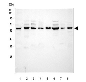 NADPH Oxidase 4 Antibody Human Cell Line WB. Western blot analysis was performed using NADPH Oxidase 4 Antibody. Lane 1: human 293T cell lysate; lane 2: human U-87 MG cell lysate; lane 3: human SH-SY5Y cell lysate; lane 4: human U-251 cell lysate; lane 5: human U-2 OS cell lysate; lane 6: human HeLa cell lysate; lane 7: human T-47D cell lysate; lane 8: monkey COS-7 cell lysate. A specific immunoreactive band is detected at approximately 65 kDa in all tested samples, consistent with the expected molecular weight of NOX4, which may also be observed at approximately 75â80 kDa due to post-translational modification and glycosylation. These results demonstrate that this NOX4 Antibody is suitable for Western blot detection of NADPH oxidase 4 across multiple human and monkey cell lines.