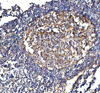 Immunohistochemical staining of FFPE human appendix tissue with VCAM1 antibody, HRP-secondary and DAB substrate. HIER: boil tissue sections in pH8 EDTA for 20 min and allow to cool before testing.