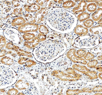 Immunohistochemical staining of FFPE human kidney tissue with VCAM1 antibody, HRP-secondary and DAB substrate. HIER: boil tissue sections in pH8 EDTA for 20 min and allow to cool before testing.