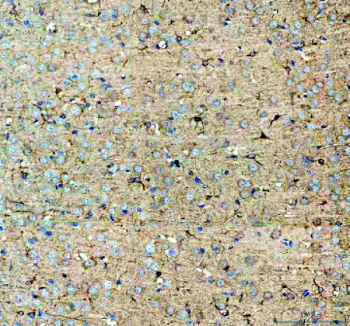 IHC staining of FFPE mouse brain tissue with Neuropeptide S antibody. HIER: boil tissue sections in pH8 EDTA for 20 min and allow to cool before testing.