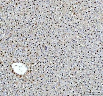 IHC staining of FFPE rat liver tissue with DCK antibody. HIER: boil tissue sections in pH8 EDTA for 20 min and allow to cool before testing.