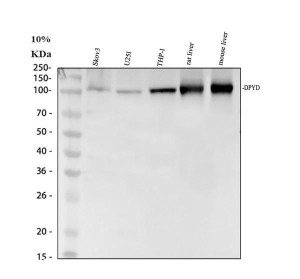 DPYD Antibody Human, Mouse and Rat Liver WB. Western blot testing of human SKOV3 (lane 1), U251 (lane 2), THP-1 (lane 3), rat liver (lane 4), and mouse liver (lane 5) lysates using DPYD antibody detected a specific band at approximately 111 kDa, consistent with the expected molecular weight of dihydropyrimidine dehydrogenase. The strongest signals were observed in rat and mouse liver, in agreement with the well-established high hepatic expression of DPYD, the rate-limiting enzyme responsible for pyrimidine and fluoropyrimidine catabolism. This DPYD Antibody, also called a DPD Antibody, is useful for investigating pyrimidine metabolism, fluoropyrimidine metabolism, chemotherapy response, and cancer pharmacology.