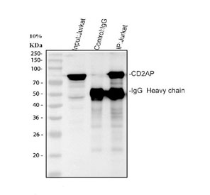 CD2AP Antibody / Cytoskeletal Adapter Protein Antibody Immunoprecipitation Validation. Immunoprecipitation of CD2AP from human Jurkat whole cell lysate using CD2AP Antibody / Cytoskeletal Adapter Protein Antibody, followed by western blot detection. Lane 1: Input Jurkat whole cell lysate. Lane 2: Control IgG immunoprecipitation (negative control). Lane 3: CD2AP antibody immunoprecipitation. A specific band corresponding to CD2AP is detected at approximately 71-80 kDa in the input and immunoprecipitated sample, while no corresponding CD2AP band is observed in the control IgG lane. The IgG heavy chain is visible at approximately 50 kDa, confirming successful immunoprecipitation.