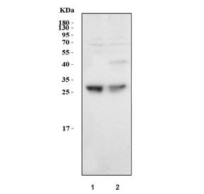 Western blot testing of human 1) HCCT and 2) HCCP cell lysate with Serum Amyloid P antibody at 0.5ug/ml. Predicted molecular weight ~25 kDa.