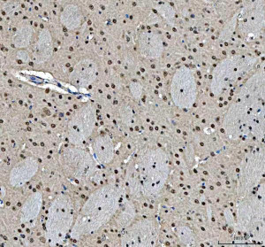 MRE11 Antibody Rat Brain IHC. Immunohistochemical staining of FFPE rat brain tissue using MRE11 antibody demonstrated predominantly nuclear staining in neuronal and glial cells, consistent with the role of MRE11 as a core component of the MRN complex responsible for DNA double-strand break detection and repair. Heat-induced epitope retrieval was performed in pH 8.0 EDTA buffer prior to staining. Tissue sections were blocked with 10% goat serum and incubated with the primary antibody (2 ug/ml) overnight at 4Â°C, followed by a peroxidase-conjugated goat anti-rabbit IgG secondary antibody. Immunoreactivity was visualized using an HRP Super Vision detection system with DAB as the chromogen. This MRE11 Antibody, also called a DNA Double-Strand Break Repair Protein Antibody, is useful for investigating genome stability, DNA damage response signaling, neurobiology, and MRN complex function.