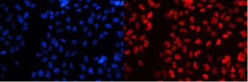 Immunofluorescent staining of FFPE human A431 cells with SF1 antibody (red) at 2ug/ml and DAPI nuclear stain (blue). HIER: steam section in pH6 citrate buffer for 20 min.