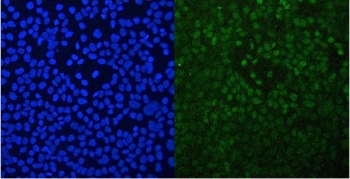 Immunofluorescent staining of FFPE human A431 cells with GNB1 antibody (green) at 2ug/ml and DAPI nuclear stain (blue). HIER: steam section in pH6 citrate buffer for 20 min.