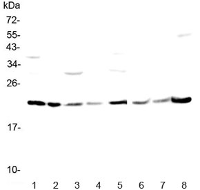 Western blot testing of rat 1) brain, 2) testis, 3) spleen, 4) thymus and mouse 5) brain, 6) testis, 7) thymus and 8) liver lysate with GLO1 antibody at 0.5ug/ml. Predicted molecular weight ~21 kDa.