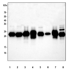Western blot testing of human 1) HeLa, 2) MCF7, 3) COLO-320, 4) 22RV1, 5) HepG2, 6) A431, 7) U937 and 8) ThP-1 cell lysate with GLO1 antibody at 0.5ug/ml. Predicted molecular weight ~21 kDa.