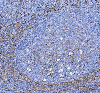 IHC staining of FFPE human tonsil tissue with S100A10 antibody. HIER: boil tissue sections in pH8 EDTA for 20 min and allow to cool before testing.