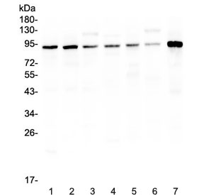 Western blot testing of rat 1) brain 2) lung, 3) liver and mouse 4) brain, 5) lung, 6) liver, 7) testis lysate with UBA2 antibody at 0.5ug/ml. Predicted molecular weight: ~72 kDa but routinely observed at ~90 kDa.